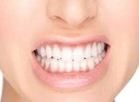 Imagen de EstrÃ©s post vacacional Â¿CÃ³mo afecta a nuestros dientes?